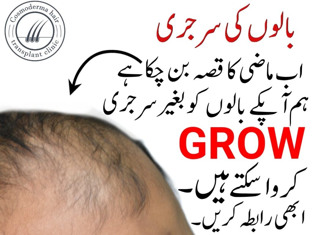 Stem cells activation treatment for hair growth Lahore Pakistan